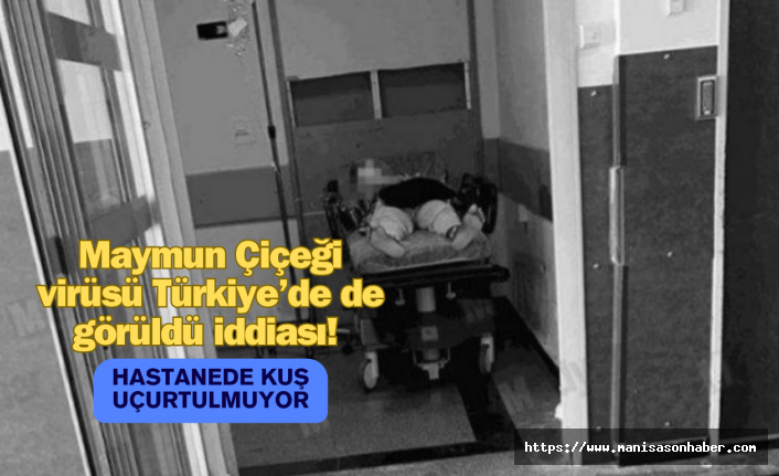 Maymun Çiçeği virüsü Türkiye’de de görüldü iddiası! Hastanede kuş uçurtulmuyor