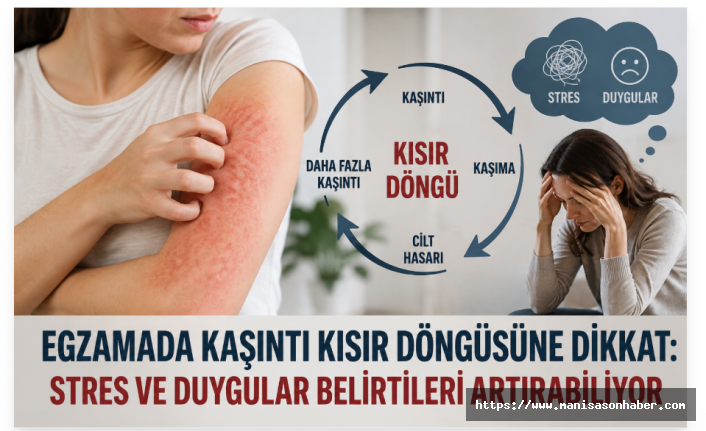Egzamada Kaşıntı Kısır Döngüsüne Dikkat: Stres ve Duygular Belirtileri Artırabiliyor
