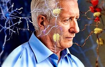Alzheimer hastalığı pandemide arttı