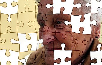 Alzheimer Yaşam Tarzı Değiştirilirse  Kaybeder!