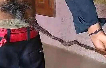 Tıp otoriteleri tarif edemiyor! 14 yaşındaki çocuğun sırtından kuyruk çıktı, insanlar tapmaya başladı