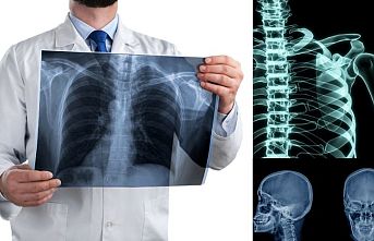 X ray cihazı nasıl kullanılır?