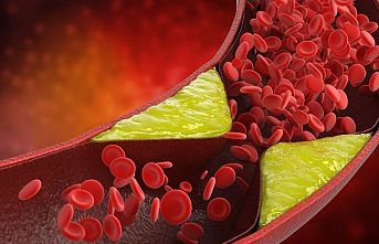 Klasik stent yöntemlerinden farklı bir uygulama 