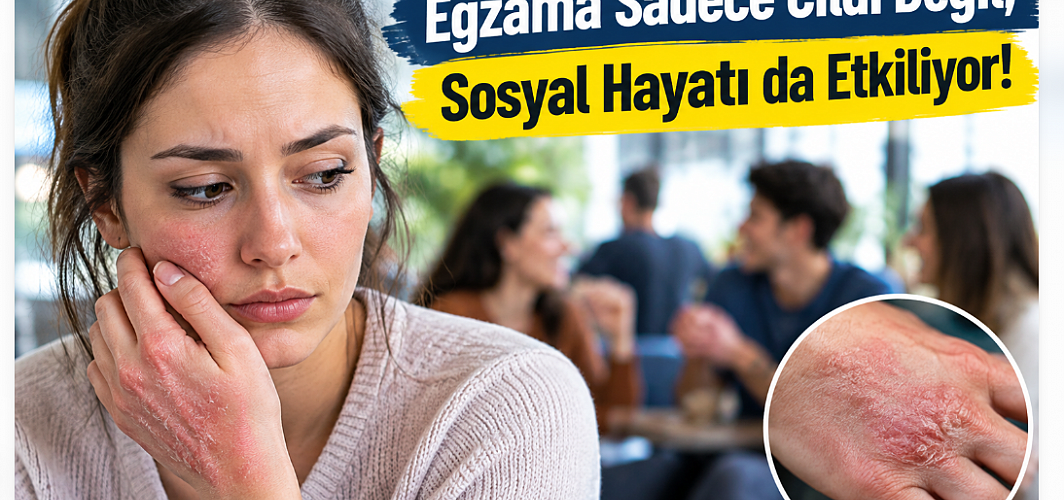 Egzama Sadece Cildi Değil, Sosyal Hayatı da Etkiliyor!