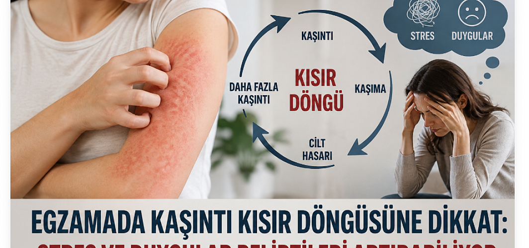 Egzamada Kaşıntı Kısır Döngüsüne Dikkat: Stres ve Duygular Belirtileri Artırabiliyor
