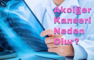 Akciğer Kanseri Neden Olur?