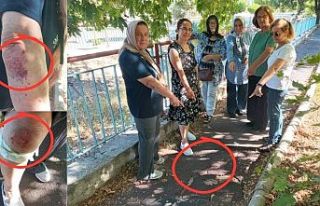 Sabah yürüyüşü yaparken yoldaki çukurlar yüzünden...