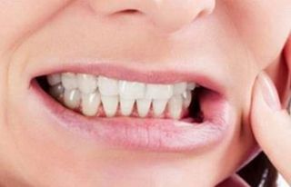 Ebeveynler Dikkat! Çocuklarda diş sıkma neyin habercisi?