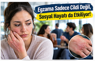 Egzama Sadece Cildi Değil, Sosyal Hayatı da Etkiliyor!