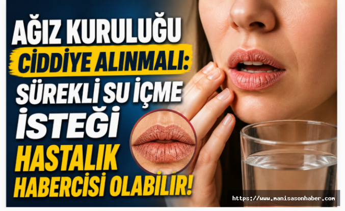 Ağız Kuruluğu Ciddiye Alınmalı: Sürekli Su İçme İsteği Hastalık Habercisi Olabilir