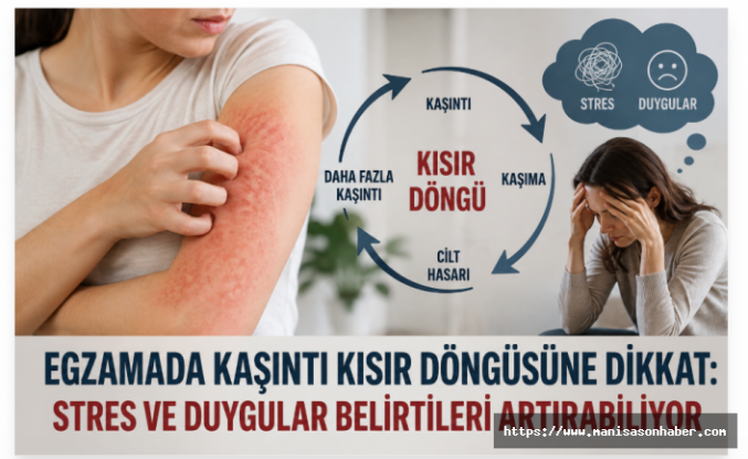 Egzamada Kaşıntı Kısır Döngüsüne Dikkat: Stres ve Duygular Belirtileri Artırabiliyor